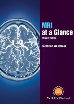 Magnetic Imaging Resonance